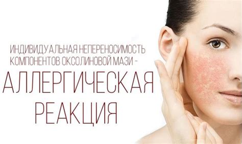 Оксолиновая мазь: инструкция по применению, состав, аналоги ...