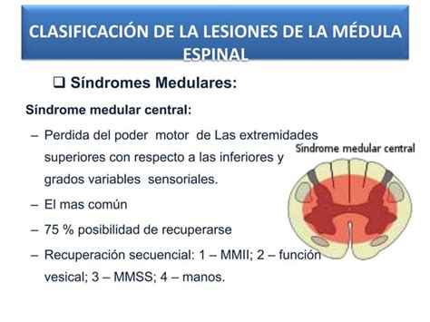 Trauma De La Columna Vertebral Y Medula Espinal Ppt