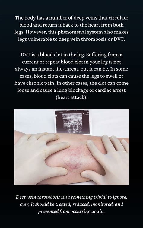 Ppt Understanding And Preventing Leg Blood Clots Dvt Powerpoint