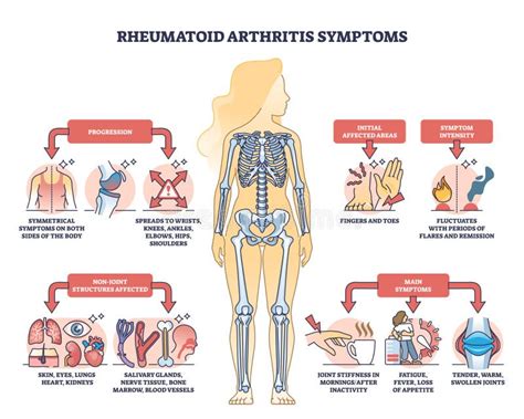 Rheumatoid Arthritis Symptoms with Joint Inflammation Disease Outline Diagram Stock Vector ...