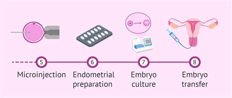 Phases Of Icsi Procedure