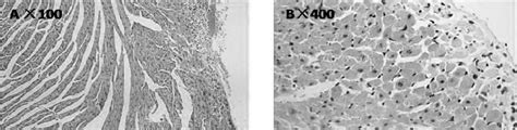 The rejection score in cardiac allografts. At day 3 after heart ...