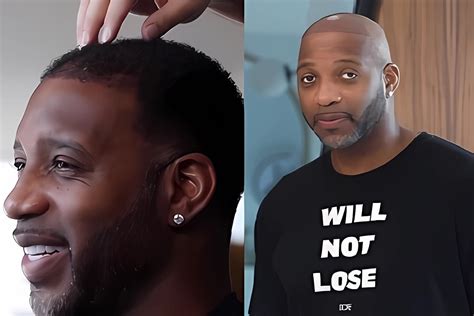 Does Tracy McGrady Have Fake Hair Tracy McGrady S Hair Transplant