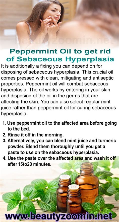 Best Ways To Get Rid Of Sebaceous Hyperplasia.Peppermint Oil Will Help ...