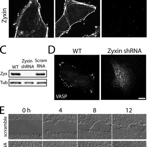 Zyxin Knockdown Cells Migrate Efficiently As A Cell Sheet A Zyxin