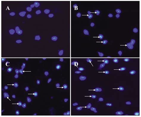 Induction Of Apoptosis Of Sw Human Colon Cancer Cells By