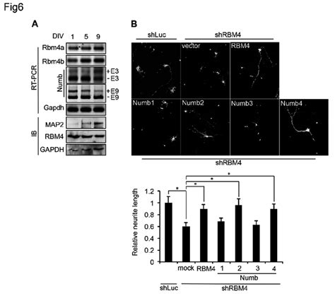 RBM4 Induced Numb Isoforms Restore Neurite Outgrowth In RBM4 Depleted