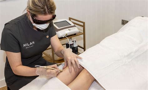 Thread Vein Treatment Reading Milan Skin Clinic