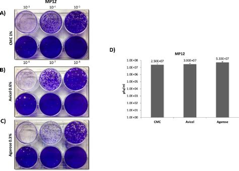 Viral Concentration Determination Through Plaque Assays Using