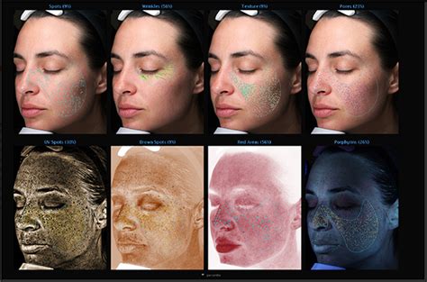 VISIA Skin Analysis Victorian Cosmetic Institute