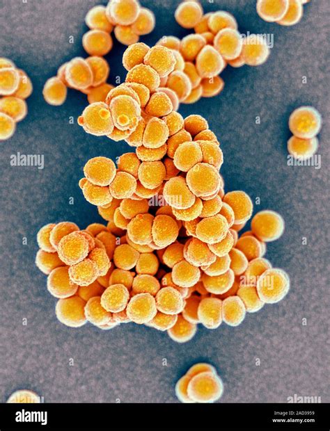 Mrsa Bacteria Coloured Scanning Electron Micrograph Sem Of