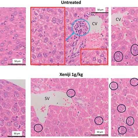 Histopathology Of The Liver From Normal Mice And Untreated And