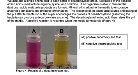 Ornithine Decarboxylase Test Principle, Procedure, Result, 48% OFF