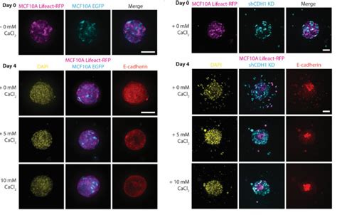 Advanced Biomatrix Collagen Stiffness Affects Spheroid Migration