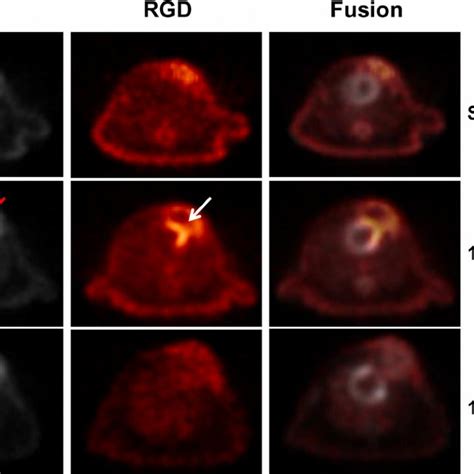 PDF PET Imaging Of Angiogenesis After Myocardial Infarction