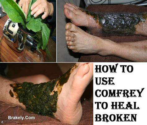 Brakely How To Use Comfrey To Heal Broken Bones Herbal Medicine