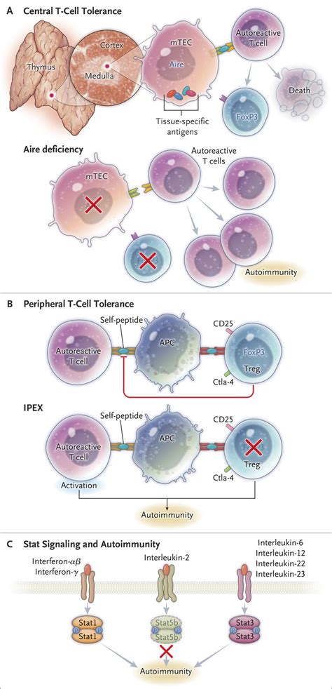 Autoimmune Polyendocrine Syndromes Nejm