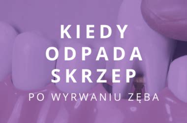 Kiedy Zak Ada Si Szwy Po Wyrwaniu Z Ba Ekstrakcja Z Szyciem Dentinfo