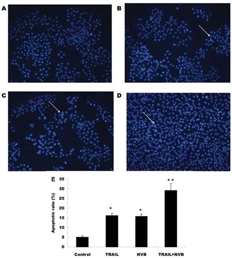 Hoechst 33342 Staining In A549 Cells A Representative Image Of Control