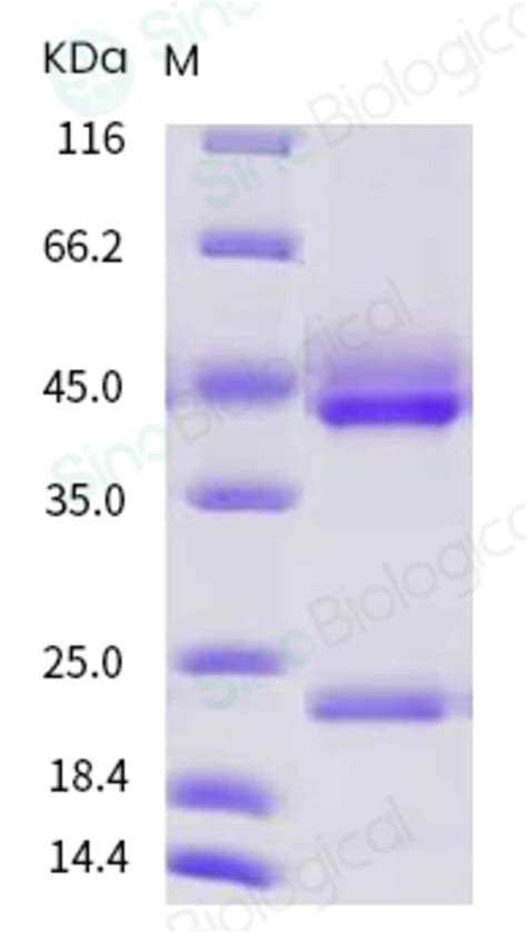 Sino Biological Human Il Il A Il B Heterodimer Protein His