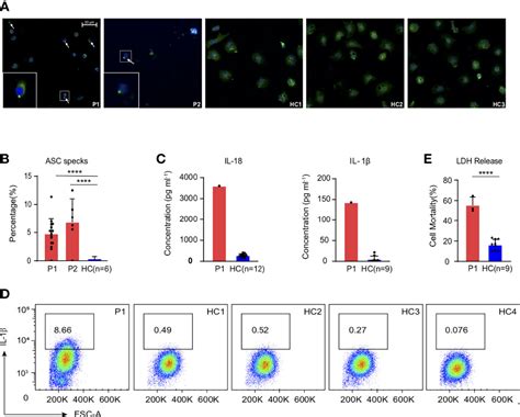 Frontiers Strong Inflammatory Signatures In The Neutrophils Of Pami