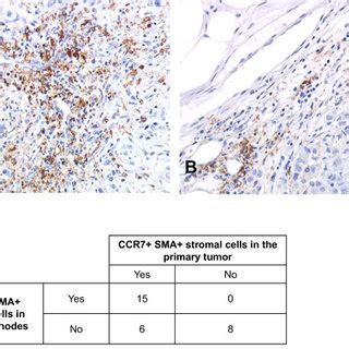 CCR7 Expressing Stromal Cells Infiltrate Metastatic Lymph Nodes Panels