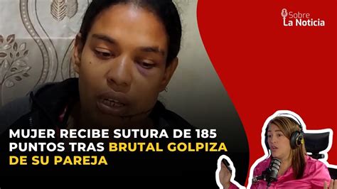 Mujer Recibe Sutura De Puntos Tras Brutal Golpiza De Su Pareja