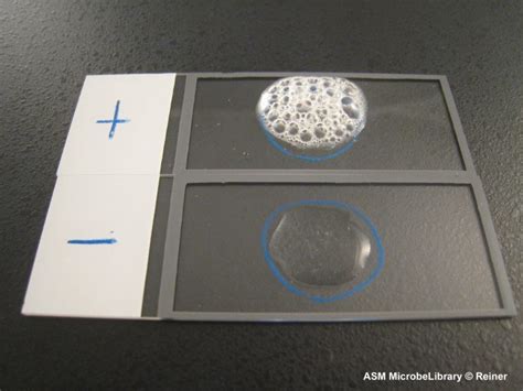 Catalase Test Principle Procedure Result Interpretation And Precautions Online Science Notes