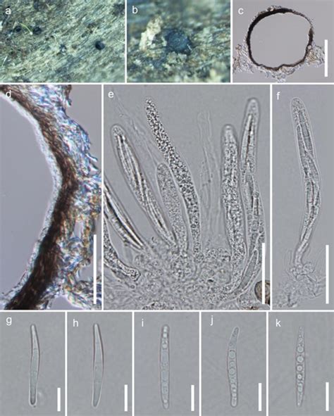 Pleurotheciella Facesoffungi Number FoF 05525 Faces Of Fungi