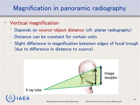 Radiation Protection In Dental Radiology Ppt Download