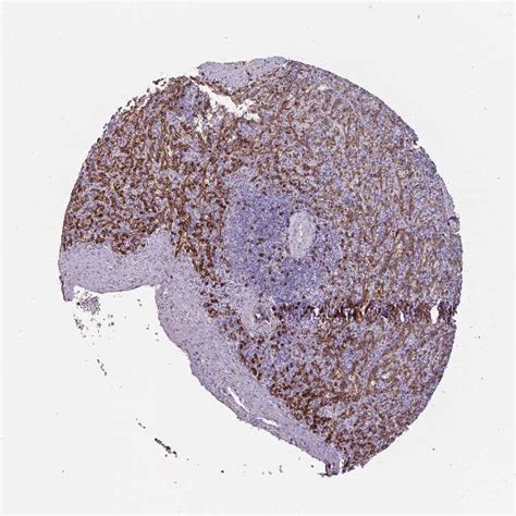 Tissue Expression Of CD8A Staining In Spleen The Human Protein Atlas