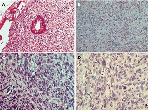 Hematoxylin And Eosin Stain Slides Of Initial Anal Biopsy Pathology Download Scientific Diagram