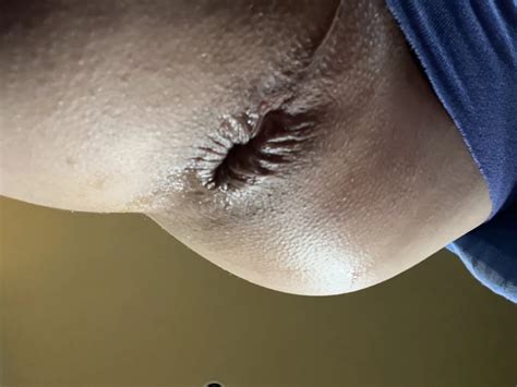 Stacelovesanal First Time Sex Machine Fucking My Ass Hole Gay Amateur Amateur Porn Xhamster