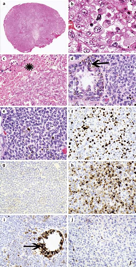 A Haematoxylin And Eosin Hande Stained Section Of The Pathology At Download Scientific Diagram