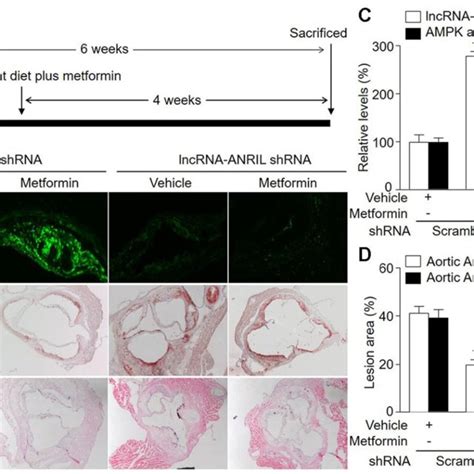 Adenovirus Mediated Knockdown Of Lncrna Anril Prevents The