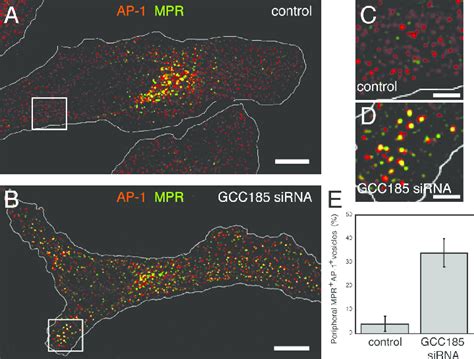 AP 1 Decorates Transport Vesicles That Accumulate In Cells Depleted Of