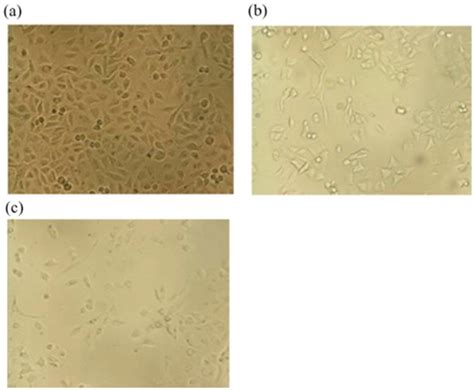 Sensors Free Full Text Graphene Incorporated Electrospun Nanofiber