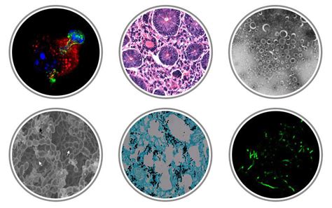 Microbiology And Immunology Tulane School Of Medicine