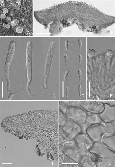 Orbilia Aff Comma A Fresh Apothecia B F Vertical Section Of An