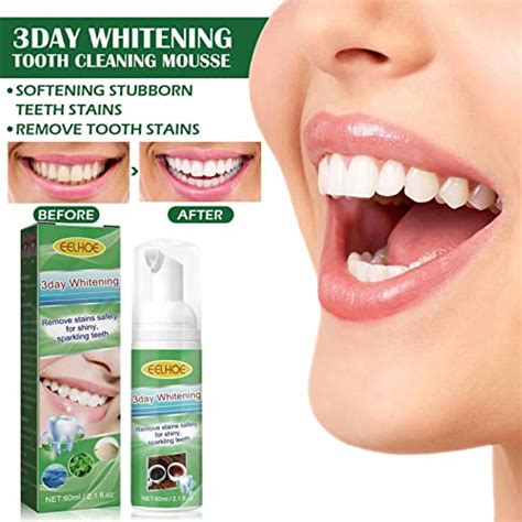 Espuma Clareadora Dentes Mousse Clareadora Dentes Ultrafina Ml