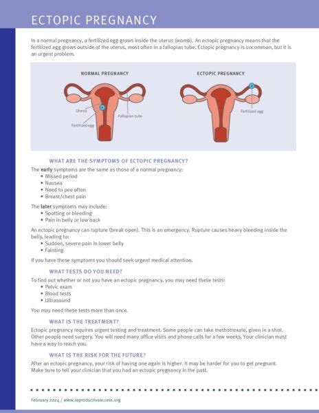 Reproductive Health Access Project Ectopic Pregnancy Fact Sheet