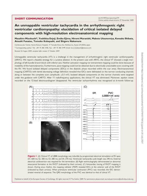 Pdf An Unmappable Ventricular Tachycardia In The Arrhythmogenic Right