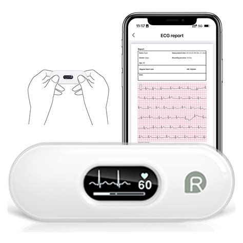 Wellue Duoek S Mobiles Ekg Ger T Bluetooth Wireless Tragbarer