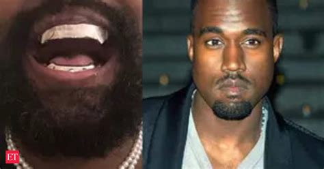 Kanye West Kanye West Gets Titanium Dentures Modeled After James Bond Villain Its Cost Will