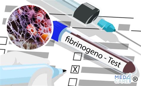 Il Fibrinogeno Cause E Trattamenti Per Eccesso O Difetto