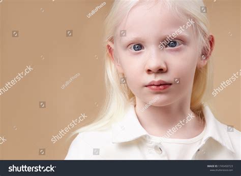 Portrait Albino Kid Girl White Skin Stock Photo 1745450723 | Shutterstock