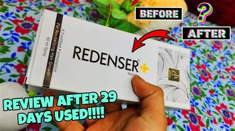 Redenser Hair Serum Honest Review After Used 💯 Hairfall Kaisa Rokhe