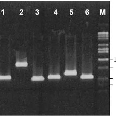 Sizes Of Its Its Pcr Products For Candida Species Before And After