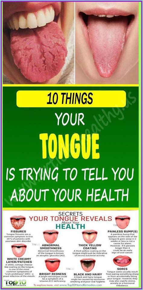 What Your Tongue Is Trying To Tell You About Your Health Tongue Health Health Tongue Sores