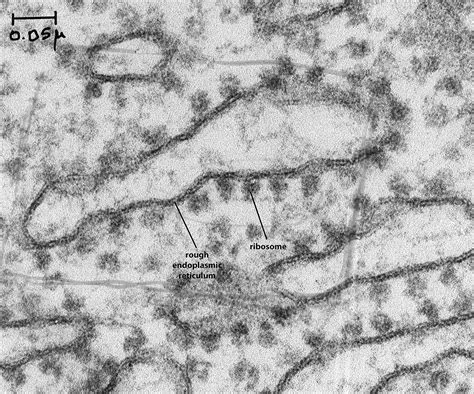 Ribosomes Electron Micrograph